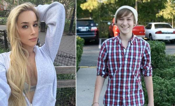 미국의 트랜스젠더 모델 라나 매디슨(29)이 하루 동안 열다섯 가지 성형수술을 받으며 겪은 경험을 공개했다. 매디슨 현재 모습과 과거 모습./사진=더 선. 매디슨 인스타그램 캡처