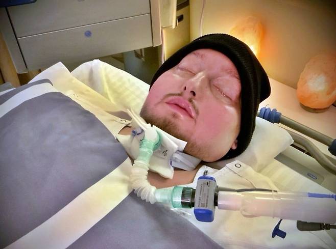 ‘잠자는 왕자’로 알려진 알 왈리드 빈 칼리드 빈 탈랄 알사우드(36) 사우디아라비아 왕자가 20년 혼수상태 끝에 19일(현지시간) 사망했다. 사진은 생전 병상의 고인. 2025.3.29 엑스