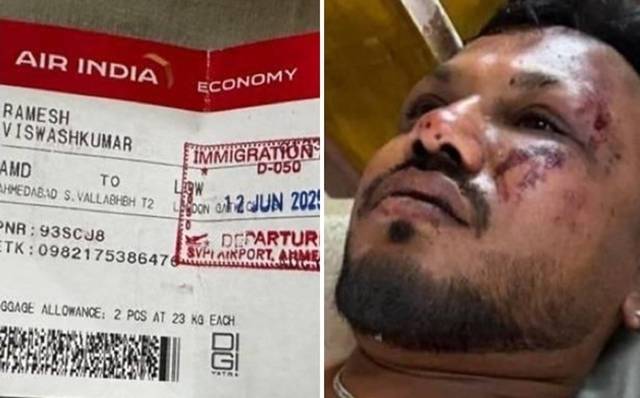 지난달 12일(현지시간) 인도 서부 구자라트주 사르다르 발라브바이 파텔 국제공항에서 이륙 직후 추락한 에어인디아 AI1717편 여객기에서 기적적으로 살아 남은 비슈와시 쿠마르 라메시(40). 2025.6.12 인디아투데이