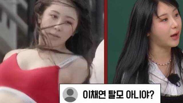 이채연은 과거 워터밤 공연에서 흑채가 물에 씻겨 내려가 탈모 논란을 겪은 후, 3571모의 머리카락을 이식받았다고 밝혔다|출처: JTBC '아는 형님' 캡처