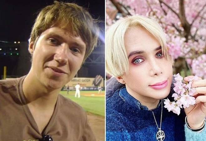 한국의 여성 아이돌 스타처럼 보이기 위해 무려 70만 달러를 쓰고 32차례의 성형 수술을 받은 영국 남성 올리 런던(35)의 수술 전후 모습. 데일리메일 제공