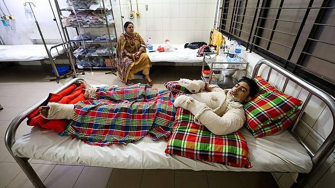 50명이 넘는 사람들이 병원에서 화상 치료를 받고 있다