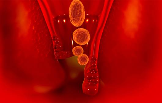 치핵ㅣ출처: 게티이미지뱅크