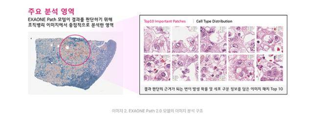 LG 차세대 암진단 AI 모델인 '엑사원 패스(EXAONE Path) 2.0'이 암이 의심되는 체내 조직을 분석한 이미지. LG 제공