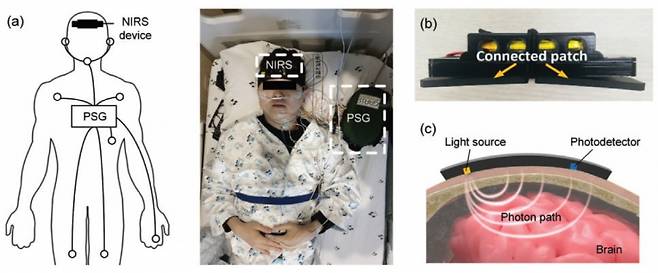 연구팀이 개발한 무선 근적외선 분광기. 이마에 부착해 수면 중 뇌 수분량을 측정하면 아교임파계 활성도를 확인할 수 있다./사진=분당서울대병원