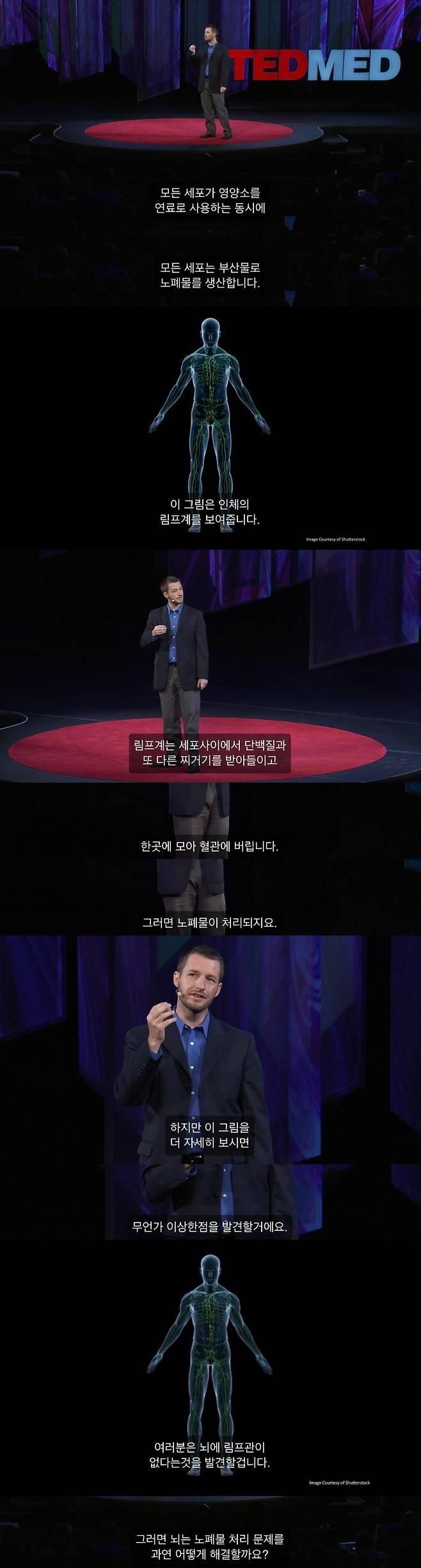 뇌가 노폐물을 청소하는 방법