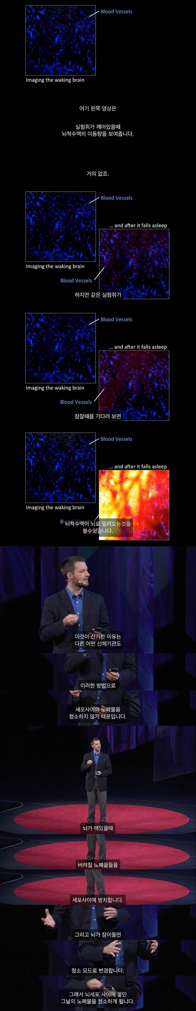 뇌가 노폐물을 청소하는 방법