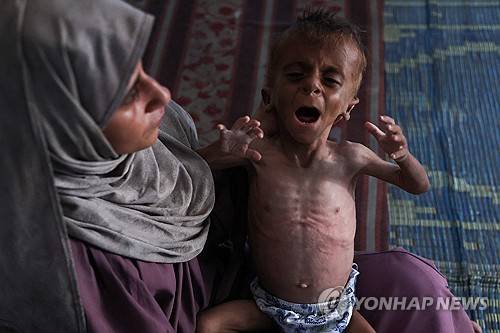 가자지구 난민촌에서 영양실조 상태의 아기를 안고 있는 팔레스타인 여성 [AFP=연합뉴스 자료사진]
