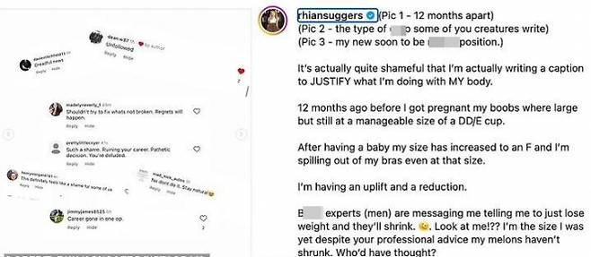 “내 몸은 내가 결정합니다” - 왼쪽은 리안 서그든의 가슴 축소 수술을 두고 쏟아진 악플, 오른쪽은 이를 정면 반박한 서그든의 글이다. 그는 “누구도 내 몸에 대해 판단할 권리가 없다”며 수술 이유와 자신의 건강 상태를 솔직하게 털어놨다. 출처=리안 서그든 인스타그램