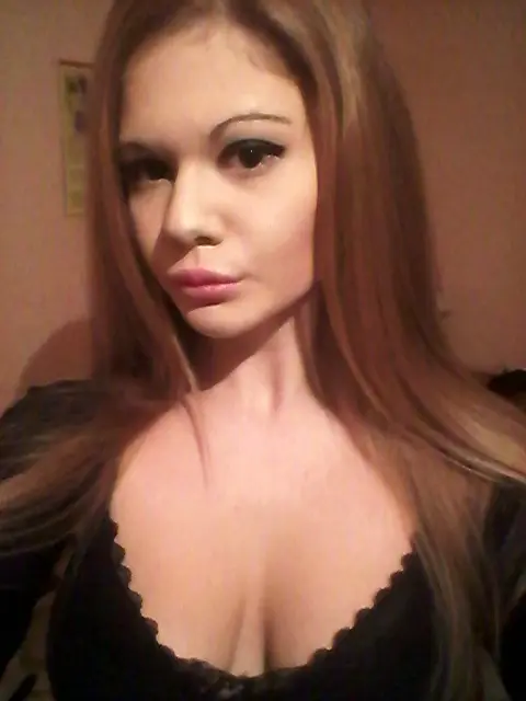 자칭 ‘세계에서 가장 큰 입술’을 가진 안드레아 이바노바의 시술 전 모습.  [데일리메일 캡처]