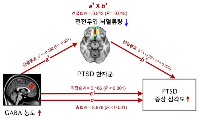 전전두엽 가바(GABA) 농도가 뇌혈류량을 통해 PTSD 증상 심각도에 미치는 영향 분석 결과. IBS 제공