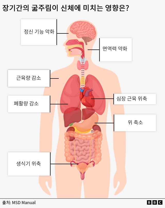장기간의 굶주림이 신체에 미치는 영향