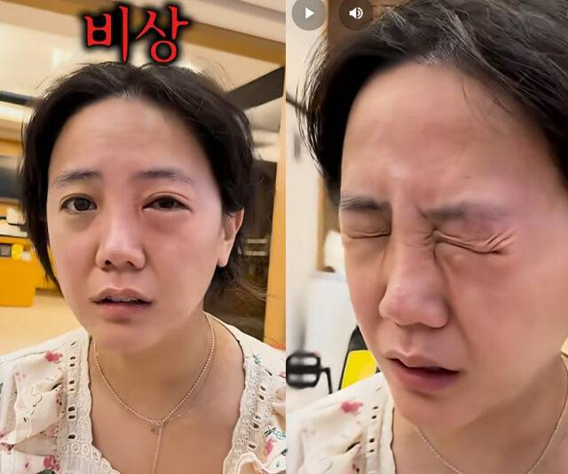 고은아의 한쪽 눈이 갑자기 퉁퉁 부었다. / 유튜브 '방가네'