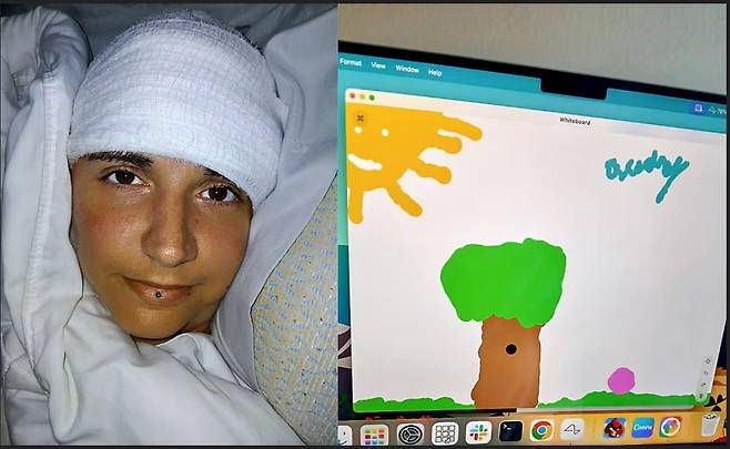 교통사고로 20년간 전신마비 상태였던 미국 여성 오드리 크루즈(왼쪽 사진). 그가 자신의 뇌에 일론 머스크의 뇌신경 스타트업 ‘뉴럴링크’의 칩을 이식해 컴퓨터 화면에 그린 그림. ‘X’ 캡처