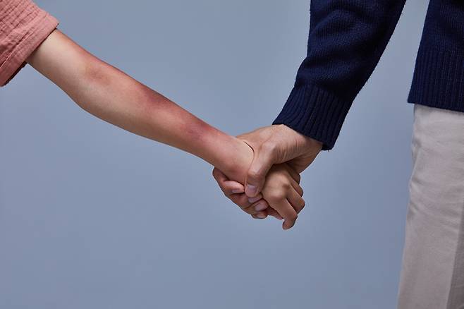 조산 끝에 아이를 숨지게 해 재판에 넘겨진 여성 A씨에게 2심 재판부는 이례적으로 낮은 형량인 징역 3년 6개월을 선고했다. 재판부는 “A씨가 전 남자친구 B씨에게 지나치게 의존하는 상황은 어린 시절 부친의 가정폭력, 부모의 이혼 등이 원인이 된 측면이 적지 않다고 보인다”고 했다.  [게티이미지뱅크]