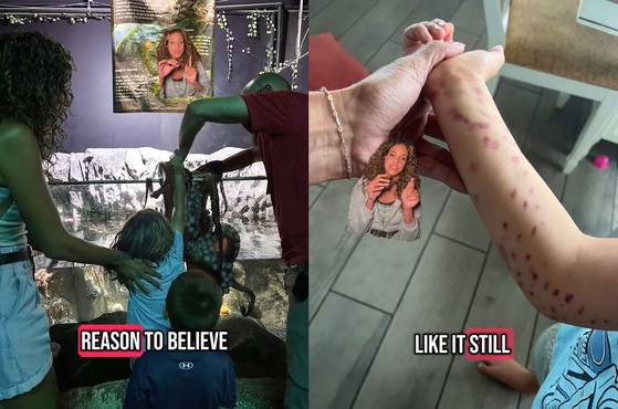 미국의 한 수족관에서 대형 문어에 팔이 잡힌 6세 소년이 몸에 수십개의 멍이 드는 사고가 발생했다. 사진 타린 틱톡 캡처