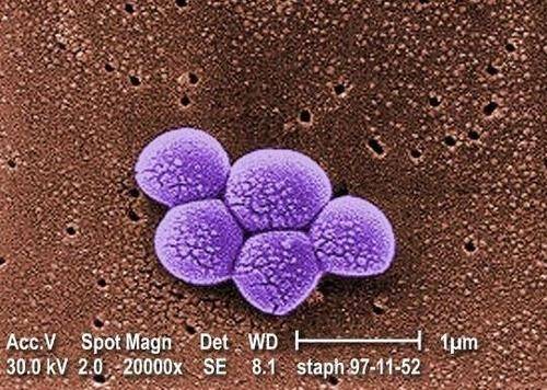 다제내성균 MRSA(메티실린 내성 황색포도상구균)를 2만 배 확대한 전자현미경 이미지 [미 CDC(질병통제예방센터) 홈페이지 캡처. 재판매 및 DB 금지]