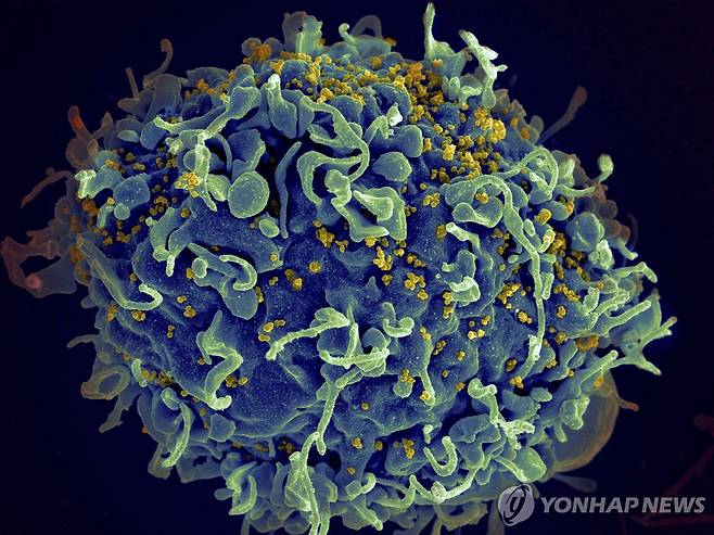 HIV Drug Approved 인체면역결핍바이러스(HIV, 노란색)의 공격을 받는 사람의 T세포(푸른색)의 전자현미경 이미지 [AP 연합뉴스 자료사진]