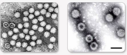 수족구병을 일으키는 장바이러스를 전자현미경으로 관찰한 모습. /사진=질병관리청 국가건강정보포털