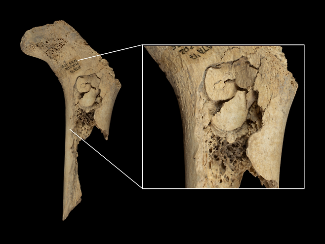 스페인 엘 미라도르 동굴에서 발견된 인간 유아의 대퇴골. 골수를 뺴기 위해 부순 흔적이 있다. IPHES-CERCA 제공