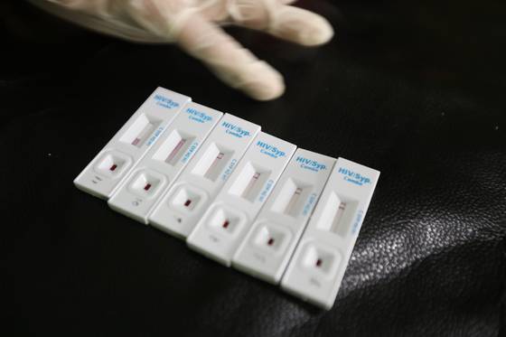 HIV 검사 키트. EPA=연합뉴스