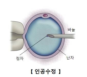 이시영 '비동의 임신' 고백 파장…생식세포 사용, 윤리·법제 사각지대 도마 위