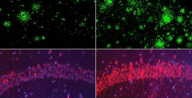 Le cerveau (à droite) de souris ayant une carence dans l'expérience de souris a beaucoup plus de plaques de protéine bêta amyloïde que le cerveau de la souris (à gauche) avec un niveau normal de lithium. Le même phénomène a également été trouvé dans Tau, une protéine de la maladie d'Alzheimer. Yankner Lab fourni