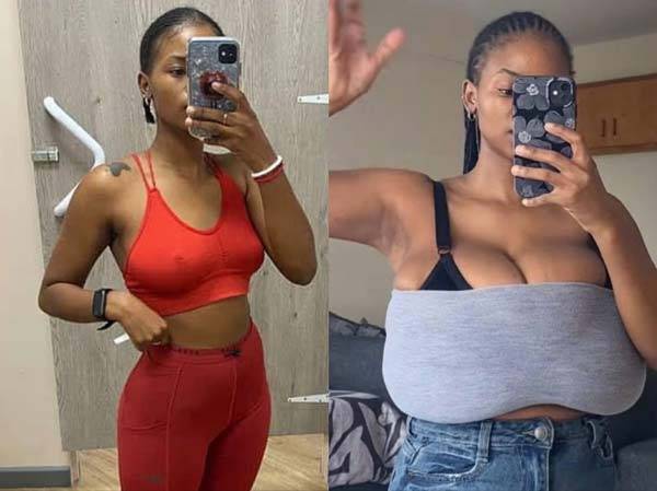 몇 달 만에 가슴 사이즈가 다섯 컵 커진 여성의 사연이 전해졌다./사진=데일리메일