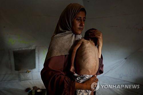 18개월 아기 모하메드 알무타와크가 어머니에 안겨있는 모습 [AFP=연합뉴스 자료사진. 재판매 및 DB 금지]