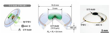 무선 OLED 콘택트렌즈 모식도와 실제 기기 사진. /사진제공=분당서울대병원