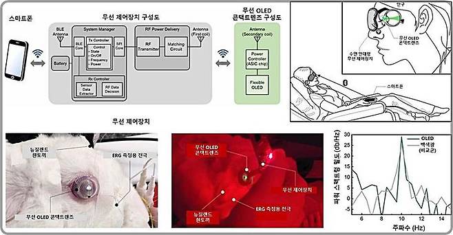 [대전=뉴시스] 무선 유기발광다이오드(OLED) 콘택트렌즈를 활용한 망막전위도 검사 시스템 모식도.(사진=KAIST 제공) 2025.08.12. photo@newsis.com *재판매 및 DB 금지