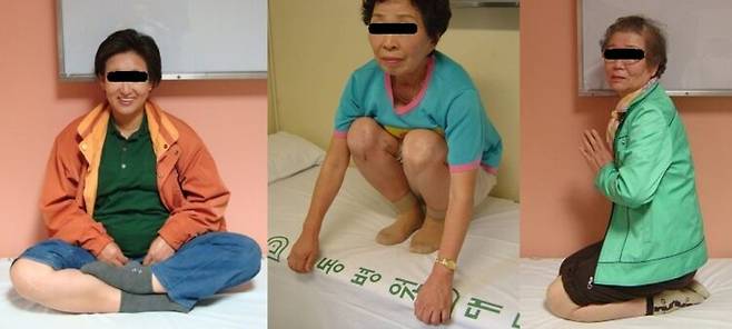 부분치환술 후 양반다리, 쪼그려 앉기, 꿇어앉기가 가능해진 실제 환자 사진.