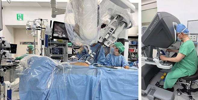 ‘다빈치 SP’를 활용한 단일공 로봇 신장이식 수술 장면. 왼쪽은 수술실 내부, 오른쪽은 서울대병원 이식혈관외과 하종원 교수가 콘솔에서 수술을 집도하는 모습