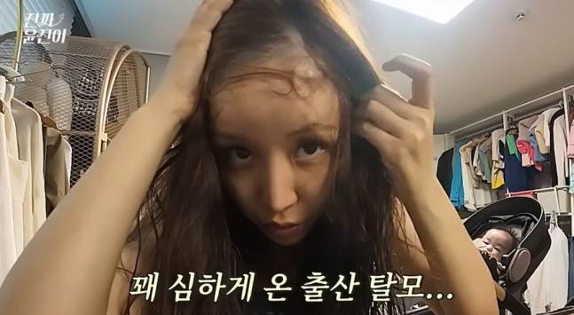 윤진이가 산후 탈모를 겪고 있다고 말했다. [사진=윤진이 유튜브 채널 영상 캡처]