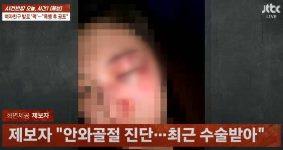 현역 태권도 선수가 길거리에서 여자친구 얼굴을 폭행하는 장면. /사진=JTBC '사건반장'