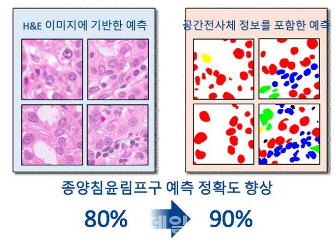 왼쪽은 기존 병리 슬라이드 분석 이미지이고, 오른쪽은 인텔리메드 세포 분석 이미지다. 인텔리메드 세포분석에선 암세포, T세포 등이 다른 색상으로 구분된다. (제공=지니너스)