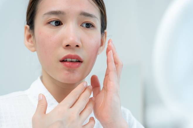 A woman touches her face with concern over skin irritation. (123rf)