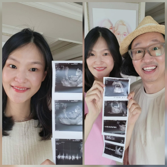 개그맨 김경진과 모델 전수민 부부가 결혼 5년 만에 기적 같은 소식을 전했다. 두 사람이 쌍둥이 부모가 된다.사진=김경진 SNS