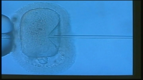 인공수정 모습. [연합뉴스]
