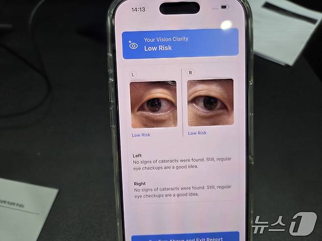 25일 서울 강남구 코엑스에서 열린 '제2회 사회적 가치 페스타' 내 카카오임팩트 부스에서 직접 체험한 CataScan의 백내장 검사 앱.  ⓒ News1 박기범 기자