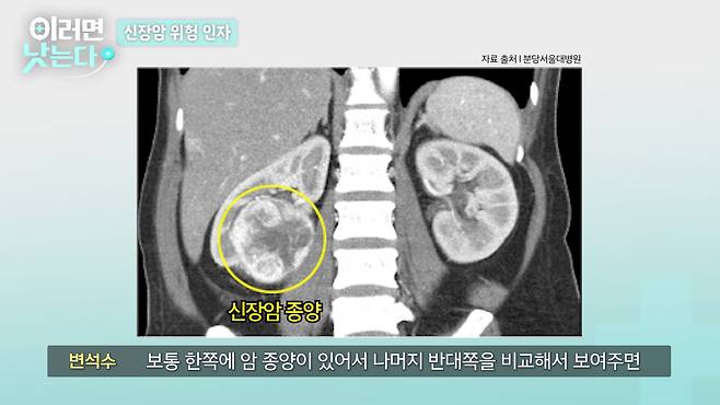 /조선일보 의학·건강 유튜브 '이러면 낫는다'