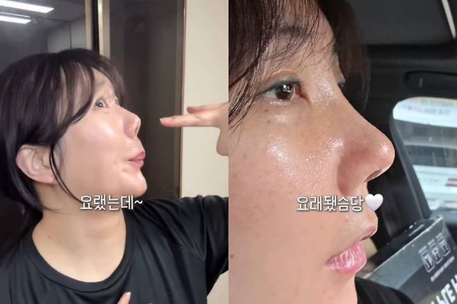 허안나. 사진|허안나 SNS