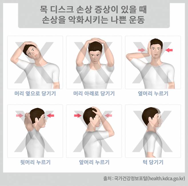 사진은 목디스크 손상을 악화하는 스트레칭. /사진=질병관리청 국가건강정보포털