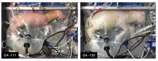 미국 필라델피아 어린이병원이 2017년 개발한 인공자궁. 바이오백