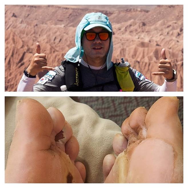 이종민 대표가 2023년 9월 칠레 아타카마사막 마라톤을 달렸다. 그는 6박 7일간 250km를 달리는 ‘지옥의 레이스’에서 첫날부터 발바닥에 물집이 잡혔지만 끝내 완주했다. 이종민 대표 제공.
