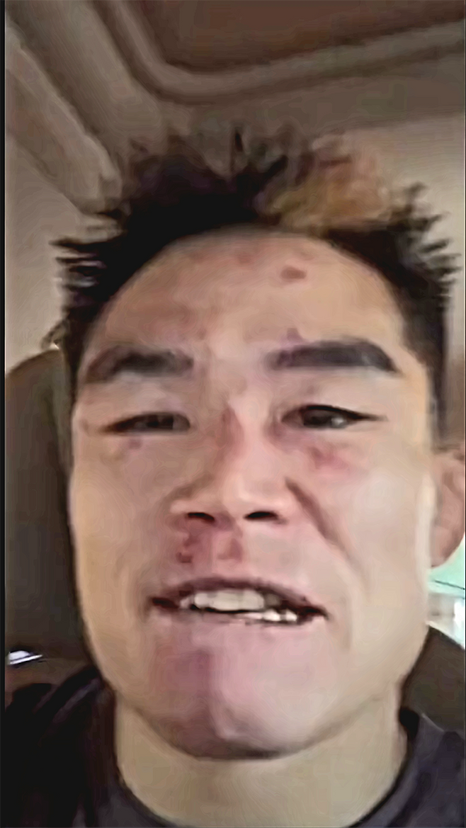 Road to UFC 시즌2 밴텀급 토너먼트 준우승자 샤오룽이 2025년 8월 중국 상하이다우타이에서 UFC 정규 파이터로 데뷔 2연승이 좌절된 후 호텔로 이동하며 소감을 말하고 있다. 사진=TKO