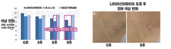 출처 : Clin Cosmet Investig Dermatol. 2013:6:29-36