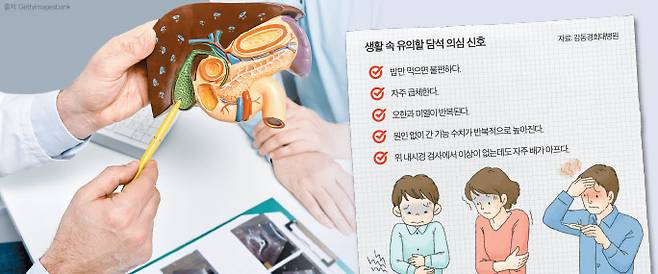 한 의료진이 담낭을 가리키며 담석에 관해 설명하고 있다. 담석은 담낭과 담관 등에 생기는 덩어리로 통증을 야기할 수 있다.