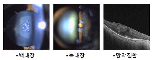 출처: 모두의안과의원