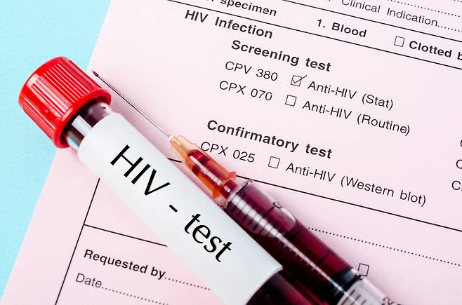 HIV 감염 관리 패러다임이 만성질환 관리 수준의 삶의 질 유지로 크게 바뀐 상황에서, 국내 관련 정책도 정비해야 한다는 지적이 나온다. 게티이미지뱅크